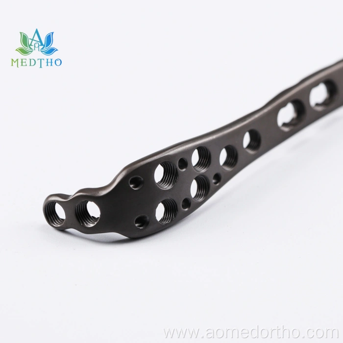 proximal ulna fracture